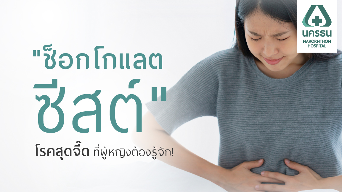 ปวดท้องประจำเดือน สัญญาณเตือน “ช็อกโกแลตซีสต์”